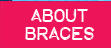 About Braces